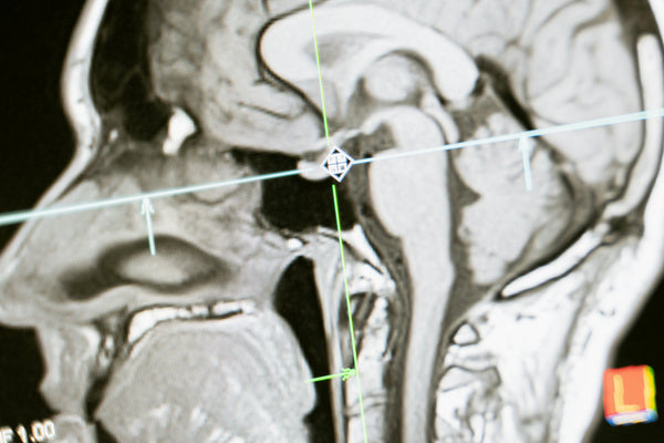 Best Non-Invasive Vagus Nerve Stimulation Devices in 2026 - Vagus Insider