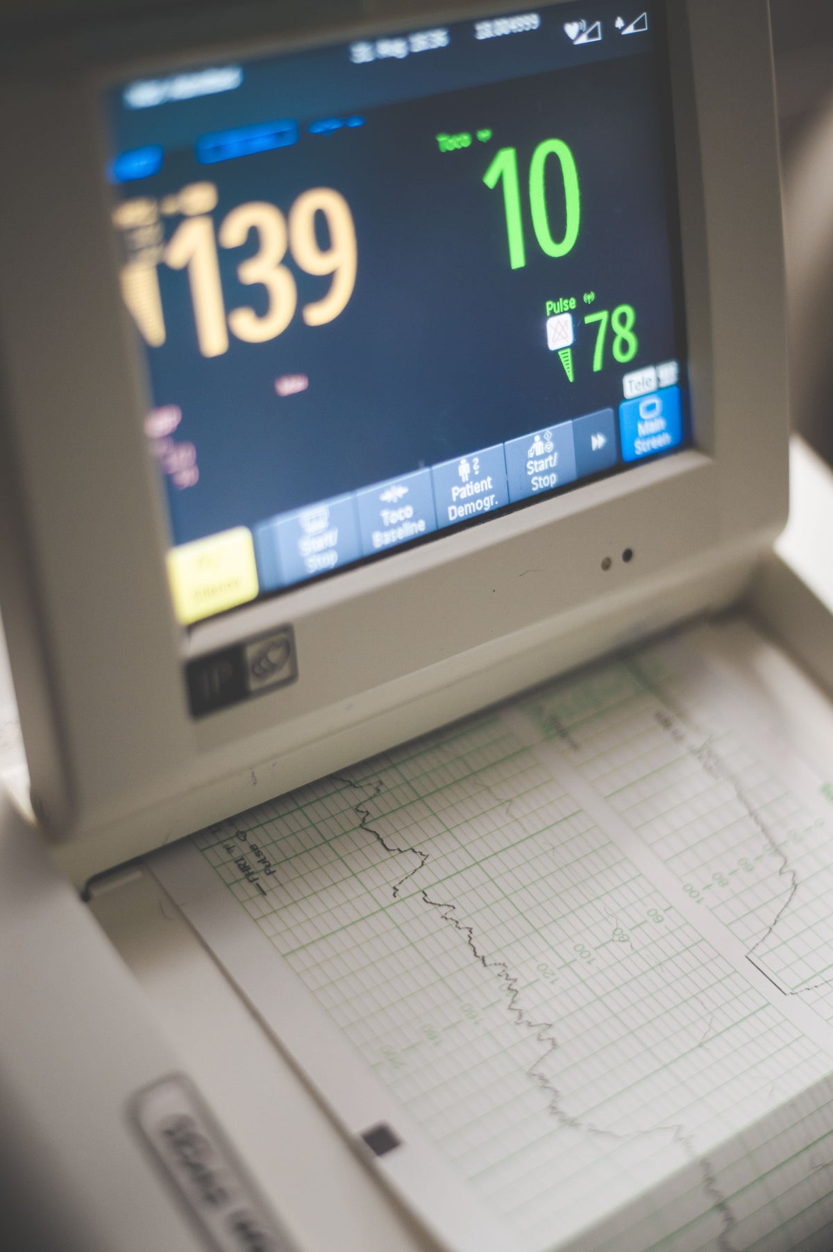 How to Measure HRV at Home: Devices, Apps and Methods Compared - Vagus Insider