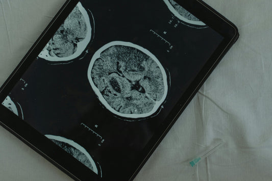Best Vagus Nerve Reset Methods in 2026 